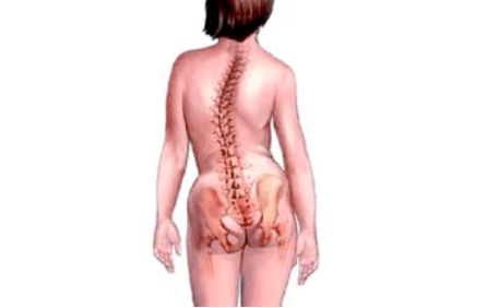 Servikal osteokondrozun gelişiminin nedenleri