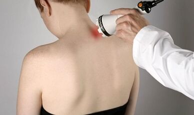 Boyun fizyoterapötik prosedürlerde ağrının tedavisi