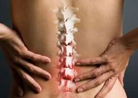 Spinal artroz ve artrit arasındaki fark nedir
