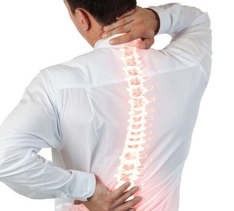 bir erkekte omurganın osteokondrozu